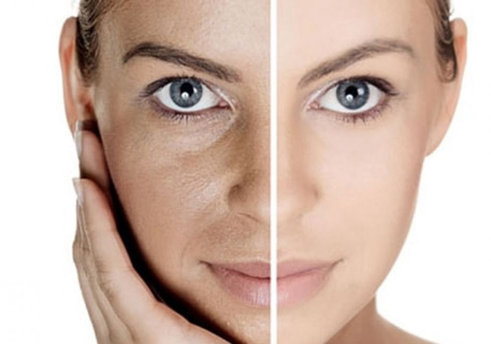 Οξυγονοθεραπεία vital O2  Οξυγονοθεραπεία vital O2